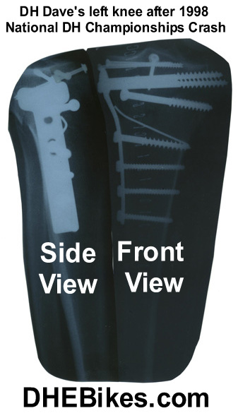 Click here to visit downhill ebikes.com